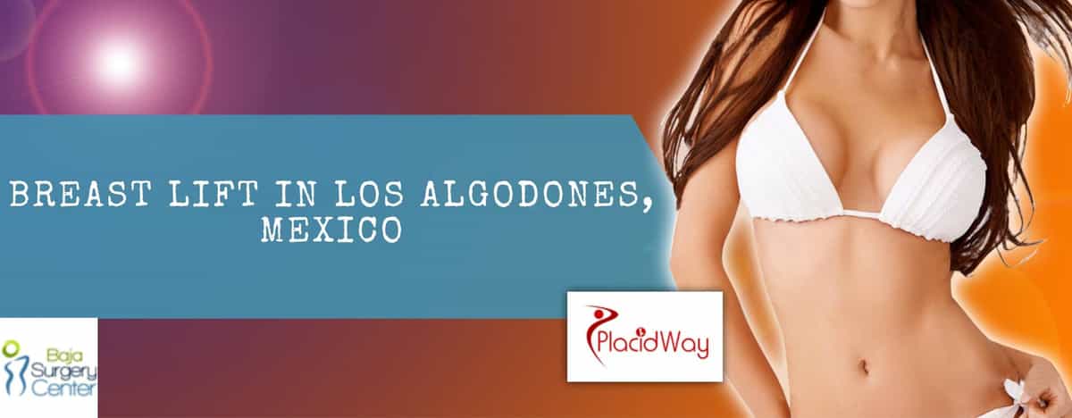 Levantamiento de senos en Los Algodones, México Breast Lift in Los Algodones, Mexico